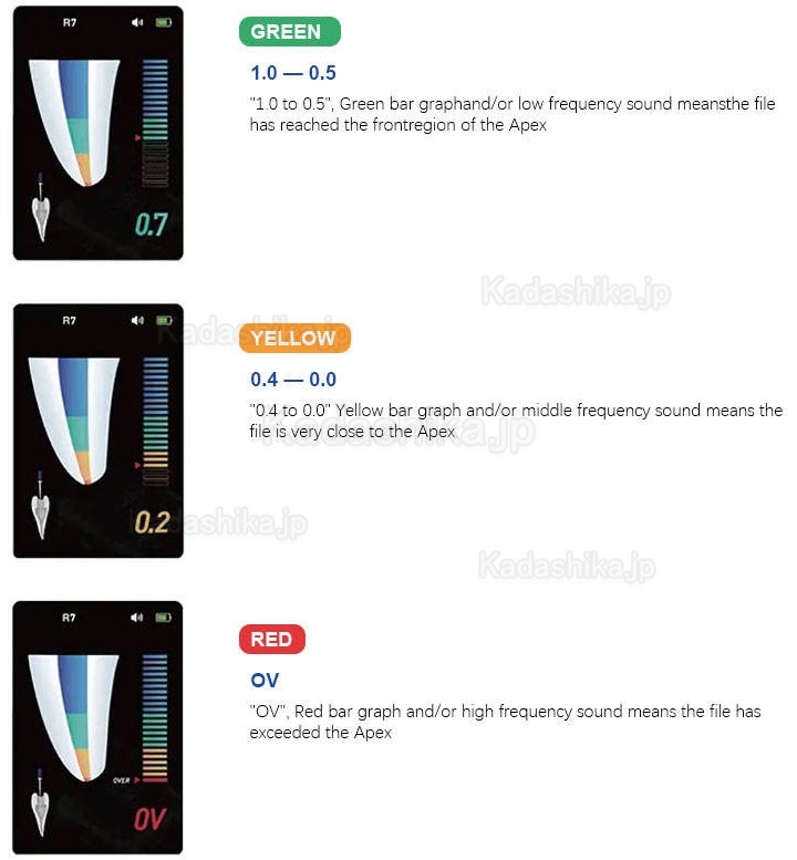歯科emr根幹長測定器 R7 ミニ電気的根管長測定器(エンドルーラー付き)